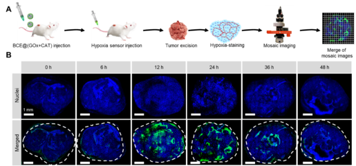 中國科學技術大學王育才教授:納米級聯(lián)簇化酶用于腫瘤葡萄糖耗竭治療